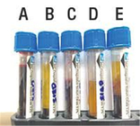 Tubo azul coagulado de la sangre del Cbc  del top, frascos de la colección de la muestra de sangre proveedor